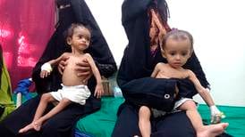 MSF: Feilernæring blant barn i Jemen øker