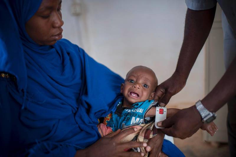 Småbarnsmoren Jila Abdulkadir Mohamed kom forleden til klinikken Jowle i Garowe i Puntland med sin utmagrede ettåring Zakaria. Måling av guttens overarm viser alarmerende rødt. UNICEF anslår 950.000 akutt undernærte somaliske barn i 2017.