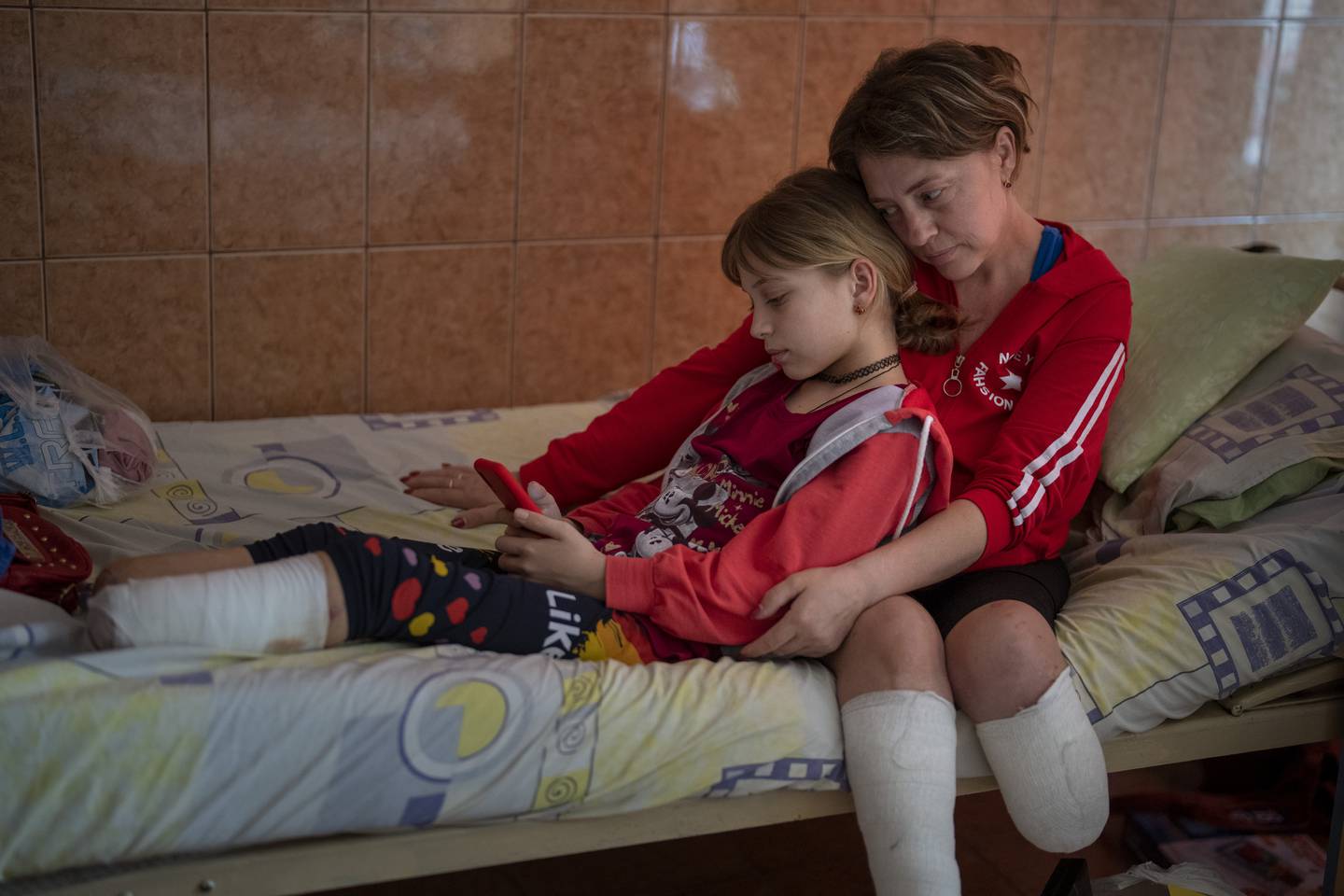 Den dagen 11-årige Yana Stepanenko skulle evakuerast, mista ho i staden begge beina i eit angrep mot jernbanestasjonen i Kramatorsk. Også mora mista eit bein. No ligg begge på eit sjukehus i Lviv vest i Ukraina. Foto: Emilio Morenatti / AP / NTB