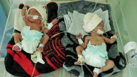 Jemens mødre og barn dør