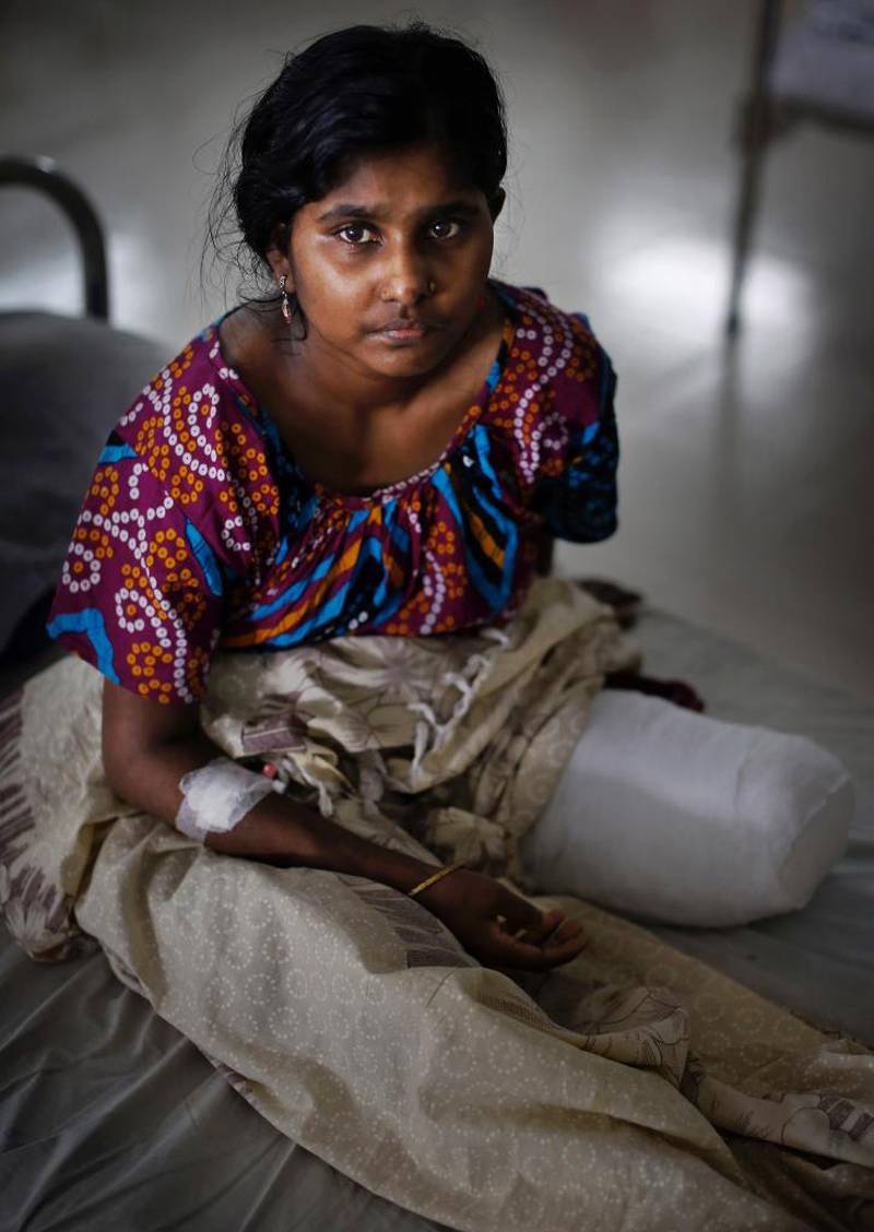 Labli (25) ble reddet etter to dager. For å få henne løs fra ruinene måtte hun amputere venstre fot.
