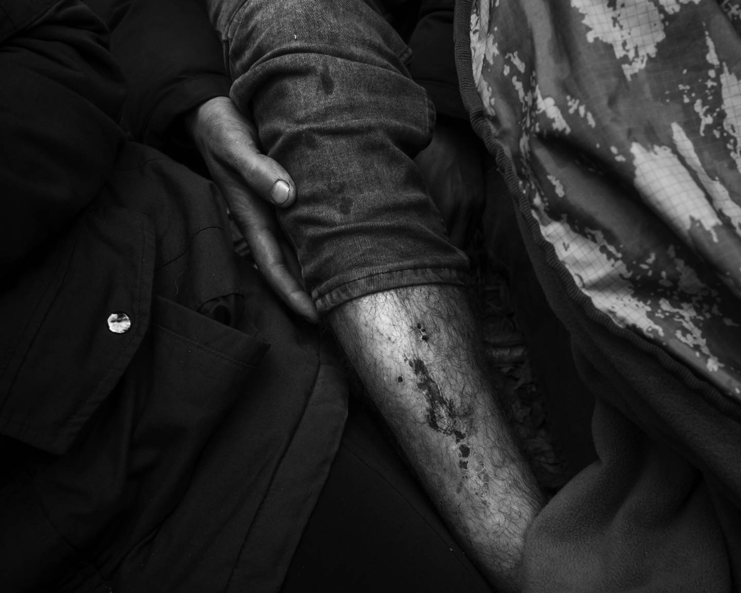 En kurdisk familie. Flere mangler sko, og sitter på bakken i kulda. En fem år gammel jente har epilepsi. 

En av dem har blitt slått av politi og bitt av hunder på hviterussisk side.