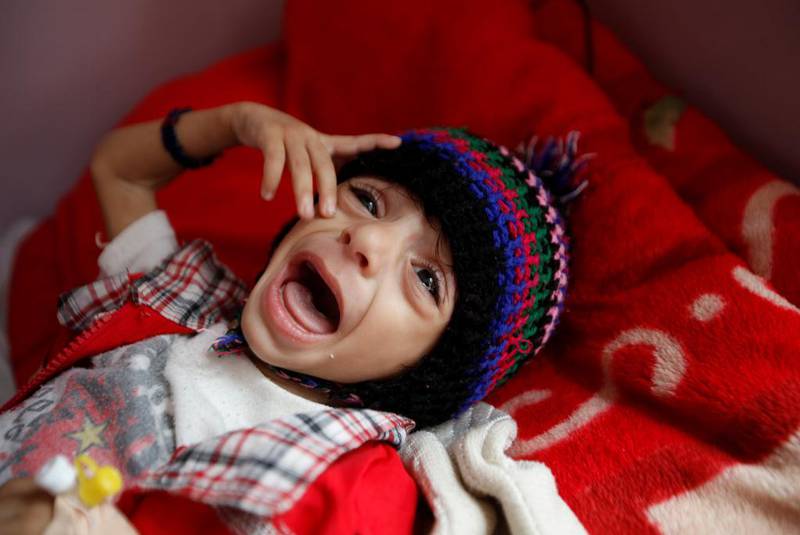 A boy cries at a hospital malnutrition intensive care unit in Sanaa, Yemen September 26, 2016. REUTERS/Khaled Abdullah    SEARCH "FAMINE YEMEN" FOR THIS STORY. SEARCH "WIDER IMAGE" FOR ALL STORIES.