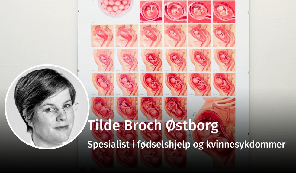 HVEM BESTEMMER? Flere partier vil skrote abortnemndene. Tilde Broch Østborg sitter selv i abortnemnd. Hun er kritisk til ordningen slik den er i dag. Bildet viser en plansje over forsterutvikling.