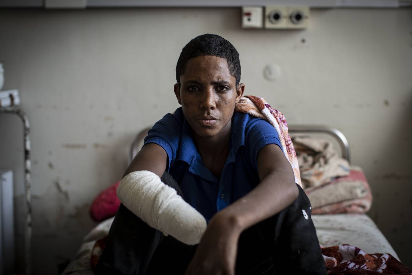 17 år gamle Haftom Gebretsadik mistet hånden i et artilleriangrep fra etiopiske regjeringsstyrker i Tigray i mars. Foto: AP / NTB