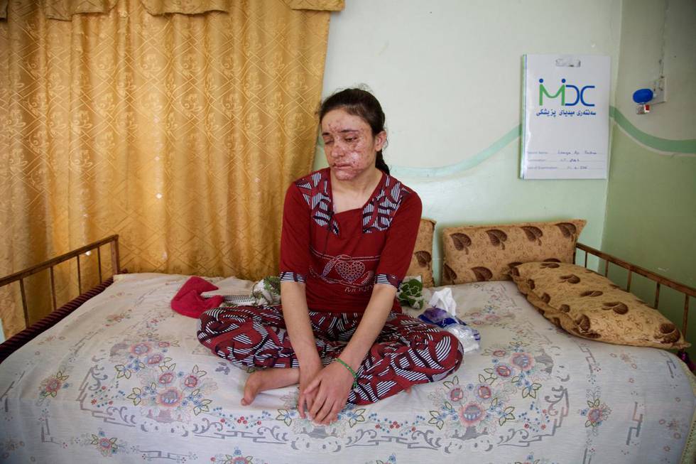 Lamiya Aji Bashar, an 18-year-old Yazidi girl who escaped her Islamic State group enslavers, talks to The Associated Press in northern Iraq in this May 5, 2016, photo. During more than a year of being passed from one militant to another, Bashar attempted to flee many times. On her fifth attempt, in March, she finally reached fighters in a Kurdish-controlled region, a safe haven for Yazidis, but only after a mine exploded, killing two girls fleeing with her and leaving Bashar's face scarred and blinding her in one eye. (AP Photo/Balint Szlanko)