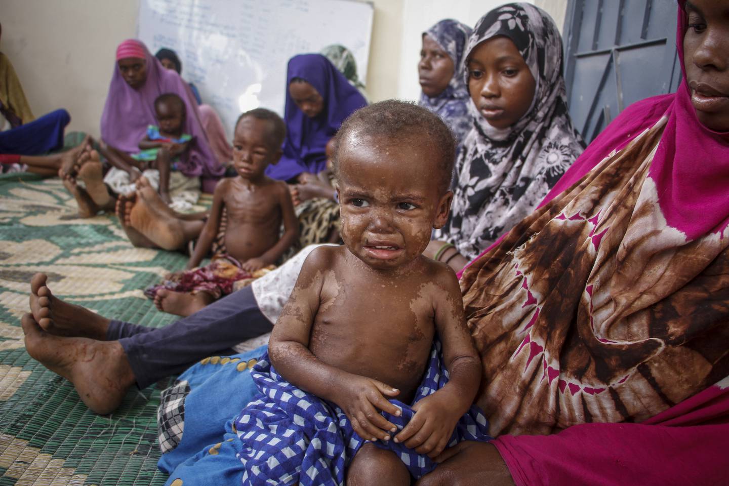 Sultkatastrofen i Somalia i årene 2010 til 2012 krevde 250.000 liv, halvparten av dem barn. Nå trues landet på nytt av en sultkatastrofe, og for mange somaliere er katastrofen alt et faktum. Foto: AP / NTB