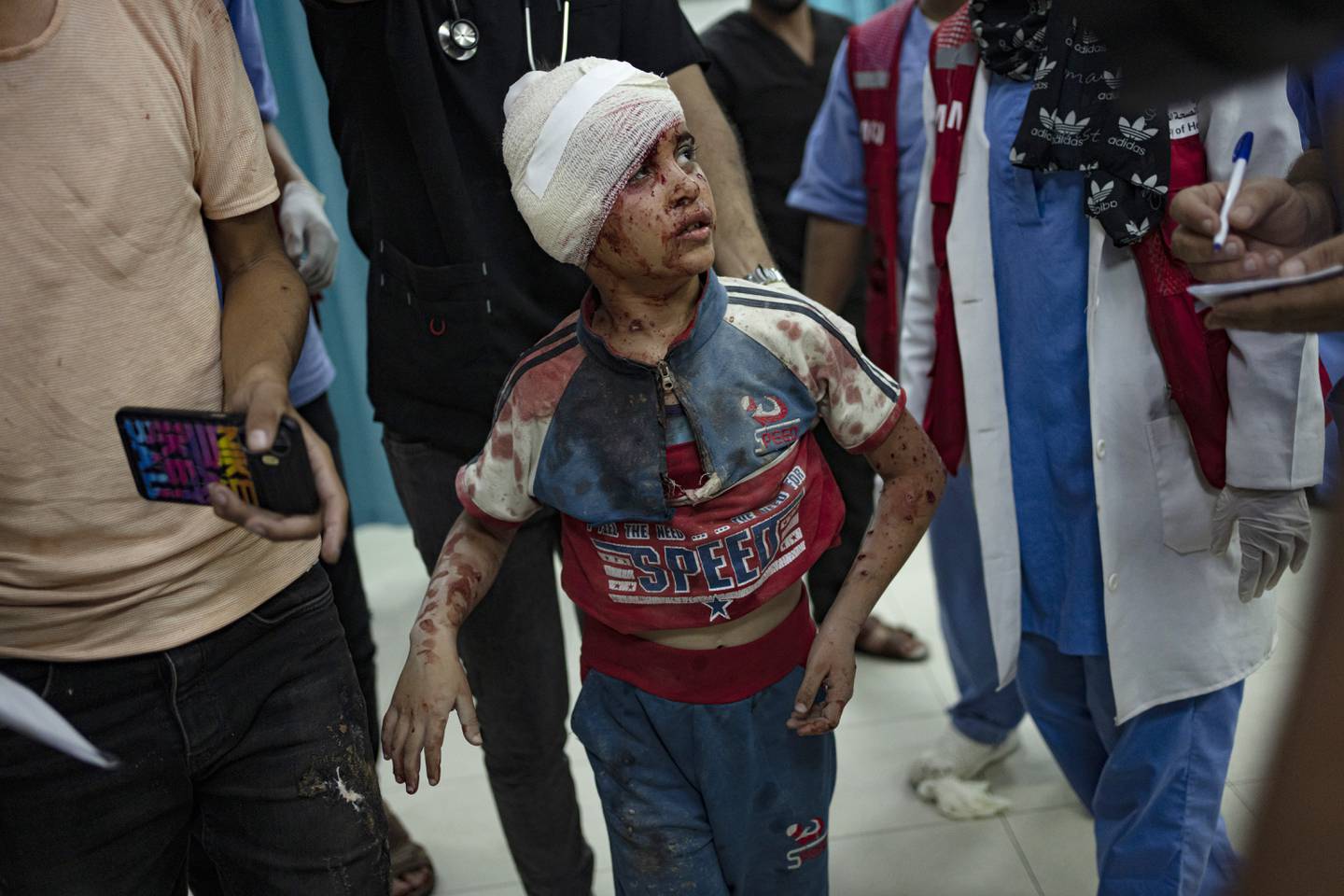 Et barn som ble såret i et israelsk luftangrep, fotografert på et sykehus i Khan Younis 21. oktober. Foto: Fatima Shbair / AP / NTB