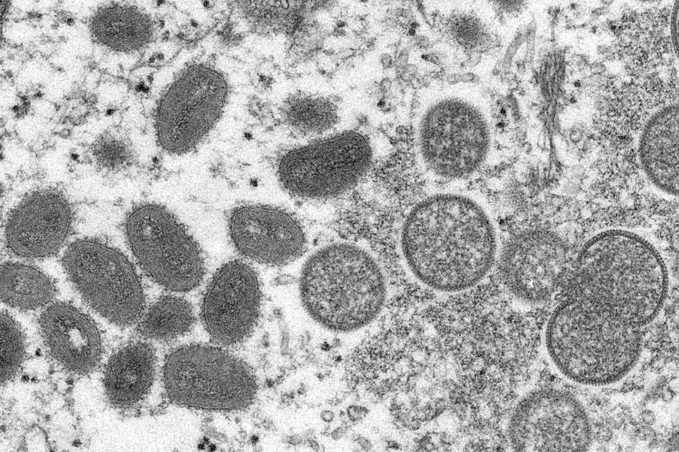 Bildet viser viruset apekopper i et mikroskop-bilde fra 2003. Tilfeller av apekopper har nå blitt oppdaget i flere land i Europa.