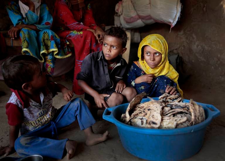 JEMEN: Krigen i Jemen har ført til en av de verste humanitære katastrofene i verden i senere år.