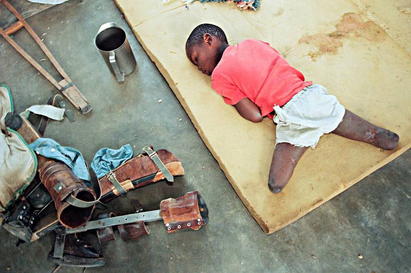 FILE - In this June 9, 1994, file photo, a young orphan, his legs amputated below the knee, rests on a foam cushion near his artificial limbs at an orphanage in Nyanza, about 35 miles southwest of the capital Kigali, Rwanda. The scale of the killings in 1994 was unimaginable but the reporting and photographs taken at the time helped to inform the world of the horrors of the genocide. (AP Photo/Jean-Marc Bouju, File)