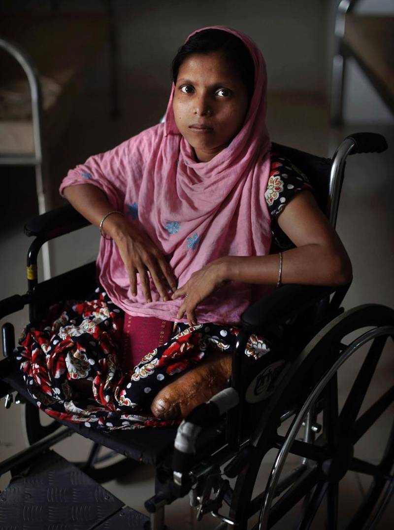Pakhi (25) ble reddet tre dager etter at fabrikkomplekset Rana Plaza kollapset, men mistet begge beina.